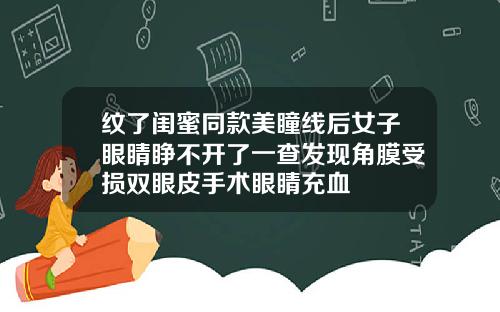 纹了闺蜜同款美瞳线后女子眼睛睁不开了一查发现角膜受损双眼皮手术眼睛充血