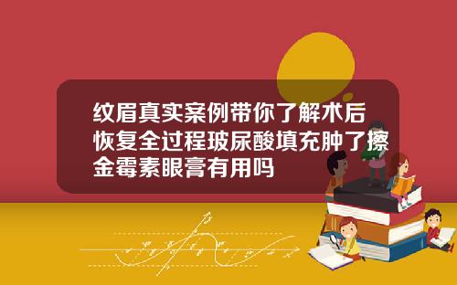 纹眉真实案例带你了解术后恢复全过程玻尿酸填充肿了擦金霉素眼膏有用吗